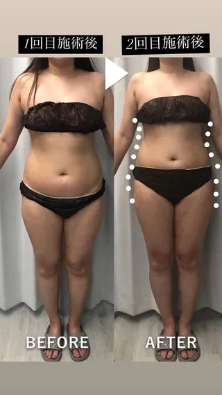 痩身・脱毛・肌管理 Rechica心斎橋のエステ・リラクイメージ