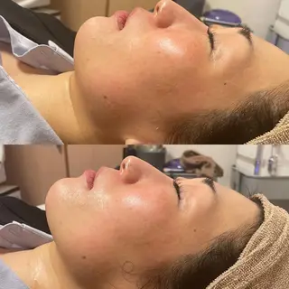 アイブロウ Epina 千葉店 【エピナ】のエステ・リラクイメージ