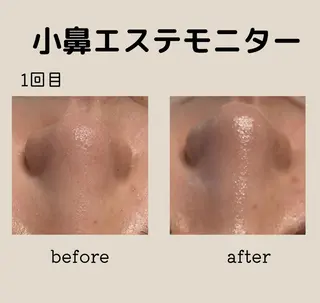 小林 玲菜のエステ・リラクイメージ