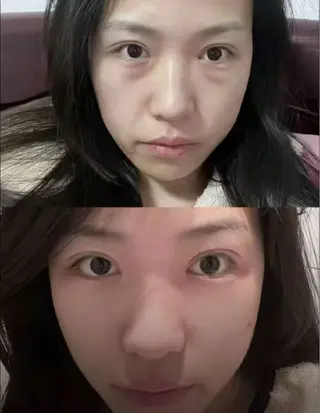 マツエク・マツパ aliaハーブ水光店 エステティシャン募集のエステ・リラクイメージ