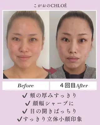 小顔サロン こがおのCHLOÉのエステ・リラクイメージ