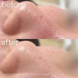 lulularico Yuのエステ・リラクイメージ