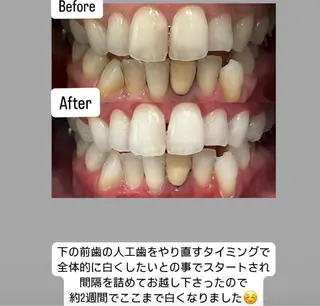 Kaula ホワイトニング🦷✨のエステ・リラクイメージ