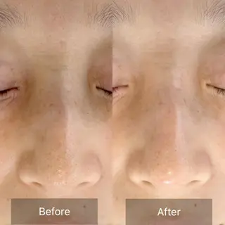 salon Shri所属・かとう みきのエステ・リラクイメージ