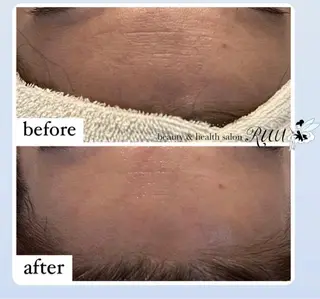 【頭痛、睡眠改善】 salon RUUのエステ・リラクイメージ