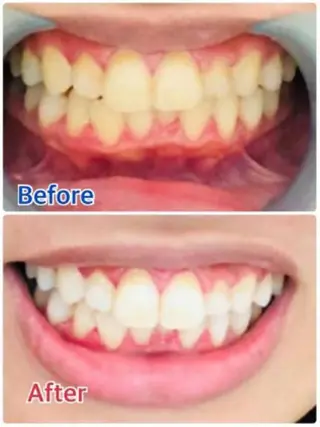 Ｍ渋谷 ホワイトニングのエステ・リラクイメージ