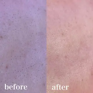 wax脱毛専門店 ハイラントのエステ・リラクイメージ