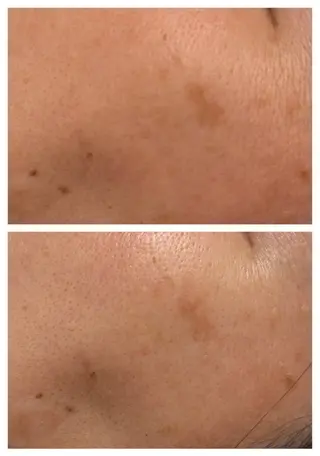 大阪大東市 / 体質・肌質改善サロン アンシャンテ所属・体質・肌質改善サロン アンシャンテのエステ・リラクイメージ