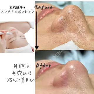 LUMINA ESTHのエステ・リラクイメージ