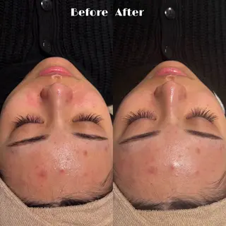 💎美容革命ラボ💎 大名店のエステ・リラクイメージ