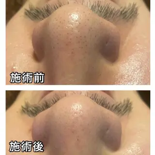 🌴Beauty Salon LANAのエステ・リラクイメージ