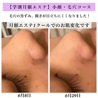 Bellesthe (ベルエステ)のエステ・リラクイメージ