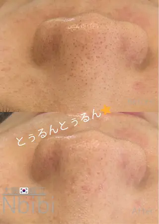 韓国🇰🇷価格 サロン_Nbibiの眉毛・アイブロウイメージ