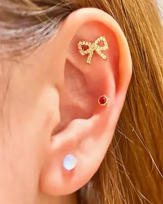 脱毛・ホワイトニング 耳ツボ・美白・毛穴のその他イメージ