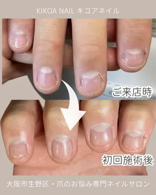 ネイル KIKOA NAIL キコアネイルのネイルデザイン