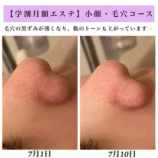 Bellesthe (ベルエステ)のエステ・リラクイメージ