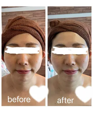 🌞シミケアサロン @SUNiko🌴のエステ・リラクイメージ