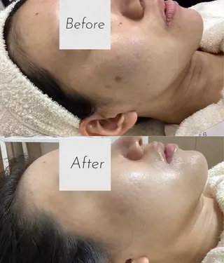 都度払い 肌質改善専門サロンのエステ・リラクイメージ