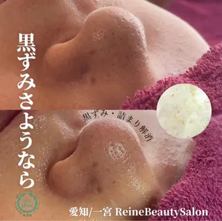 毛穴/シミ肝斑/脱毛 横山梨里のエステ・リラクイメージ