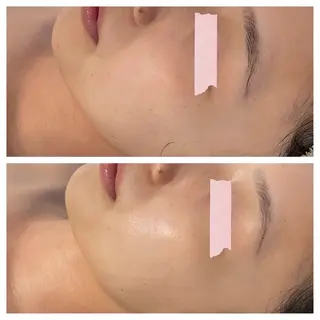 中目黒ハーブピーリン グ🌿ララピールのエステ・リラクイメージ