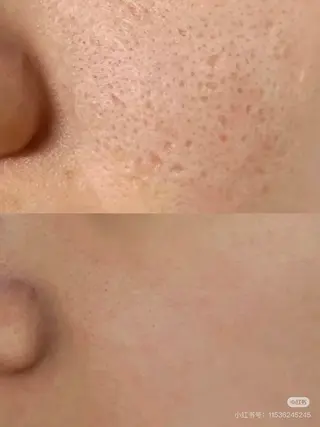 カラー aliaハーブ水光店 エステティシャン募集のエステ・リラクイメージ