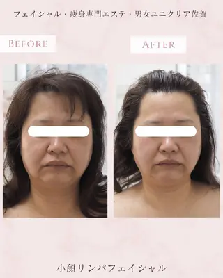 ユニセックスエステサロンUniclear所属・佐賀💎痩身エステ 夏までに痩せる🔥のエステ・リラクイメージ