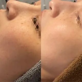 シミケア専門店モルセラ所属・シミケア専門店 モルセラのエステ・リラクイメージ