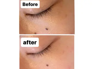 脱毛・エステサロン LuLuNのエステ・リラクイメージ