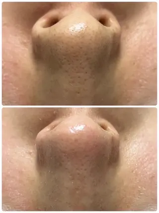 メンズ 美 Faceのエステ・リラクイメージ