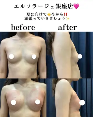 エルフラージュ 銀座店のエステ・リラクイメージ