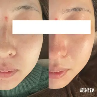 サロンドフルベール 折尾店のエステ・リラクイメージ