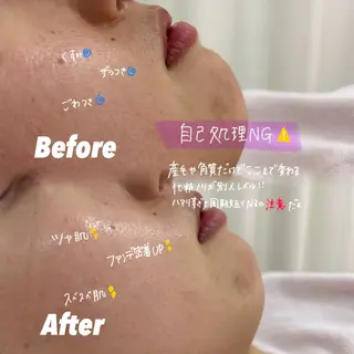 🫧美しい素肌へ🫧 今成柚乃のその他イメージ