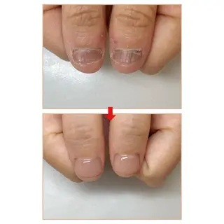 ネイル ネイルサロン アリュームのネイルデザイン