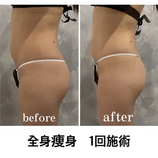 林 陽向のエステ・リラクイメージ