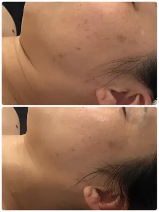 メナードフェイシャルサロン　リンガーデン所属・田中 友佳理のエステ・リラクイメージ