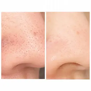 MyFairLady miuのエステ・リラクイメージ