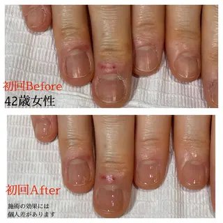 ネイル 自爪育成専門サロン エムロードゥ池下のネイルデザイン