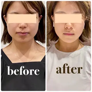 小顔矯正専門店Cream所属・菅野 もえのエステ・リラクイメージ