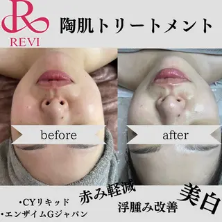 beauty salonWのエステ・リラクイメージ