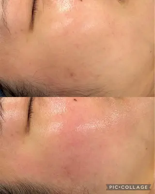 インディバサロン　ソレイユ所属・indiba soleilのエステ・リラクイメージ