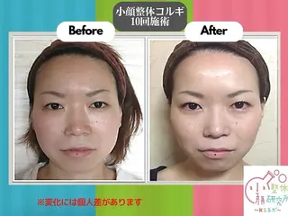 小顔整体研究所 KSラボ横浜店のエステ・リラクイメージ