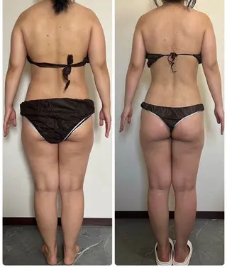 痩身Relives 金町店のその他イメージ