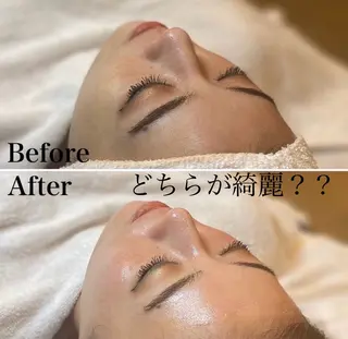 CHIO🌷心斎橋 毛穴・艶肌専門店のエステ・リラクイメージ