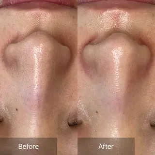 ebcs 8のエステ・リラクイメージ