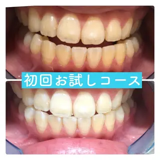 ホワイトニングルーム 横浜店のその他イメージ
