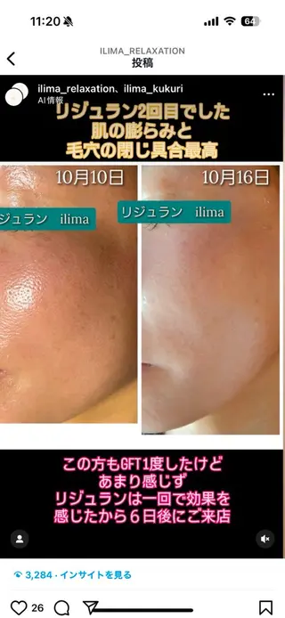ilima NARUMIのエステ・リラクイメージ