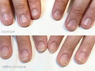 ネイル cachette mのネイルデザイン