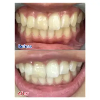 M渋谷 ホワイトニングのエステ・リラクイメージ