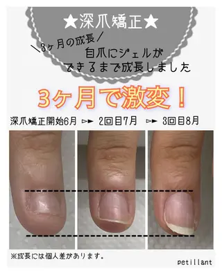 ネイル nail salon petillantのネイルデザイン