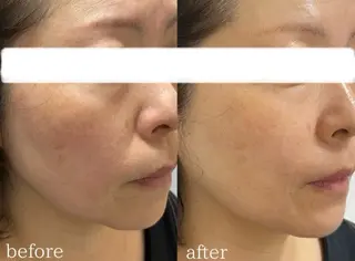 【医療提携サロン】Mbelle所属・肌質改善Mbelle 越谷レイクタウン🌿のエステ・リラクイメージ